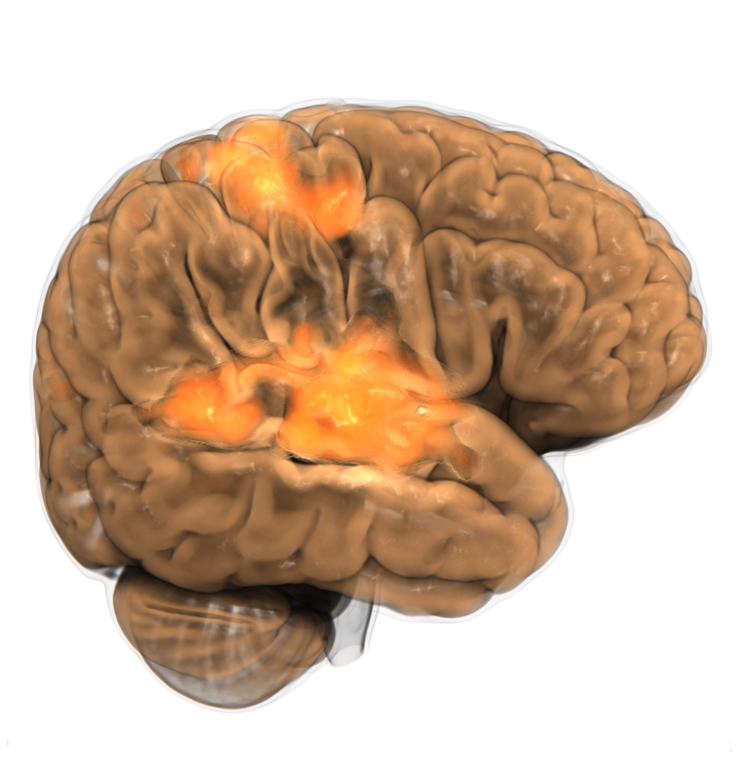Human brain, scanned